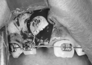 Dentiste Saint Mandé